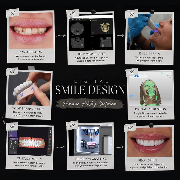 Previzualizați-vă noul zâmbet cu ajutorul tehnologiei Digital Smile Design