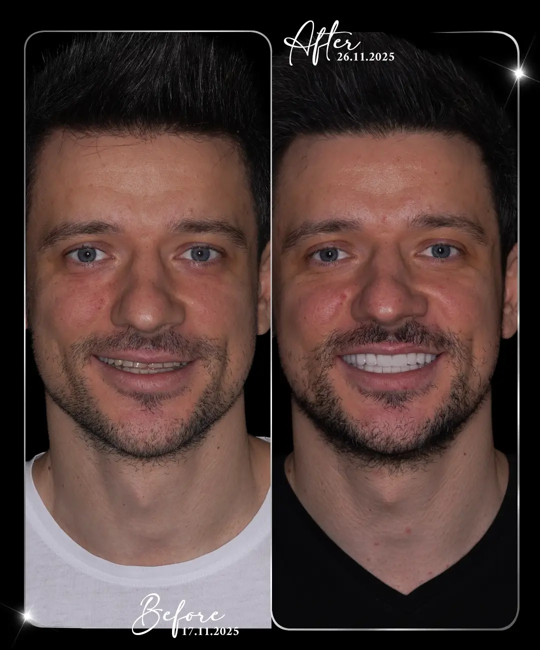 Lamine – Înainte și după – 5